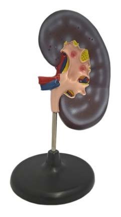 مجسم تشريح الكلية مع حامل